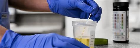 dilution of urine for drug testing